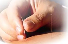 acupuncture_clip_image002